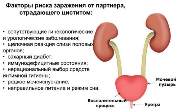 Когда после цистита можно заниматься интимной жизнью